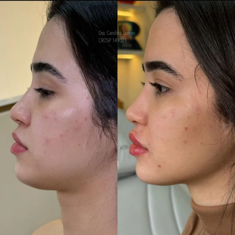 AeD Carolina - Bruno Conzi - 1