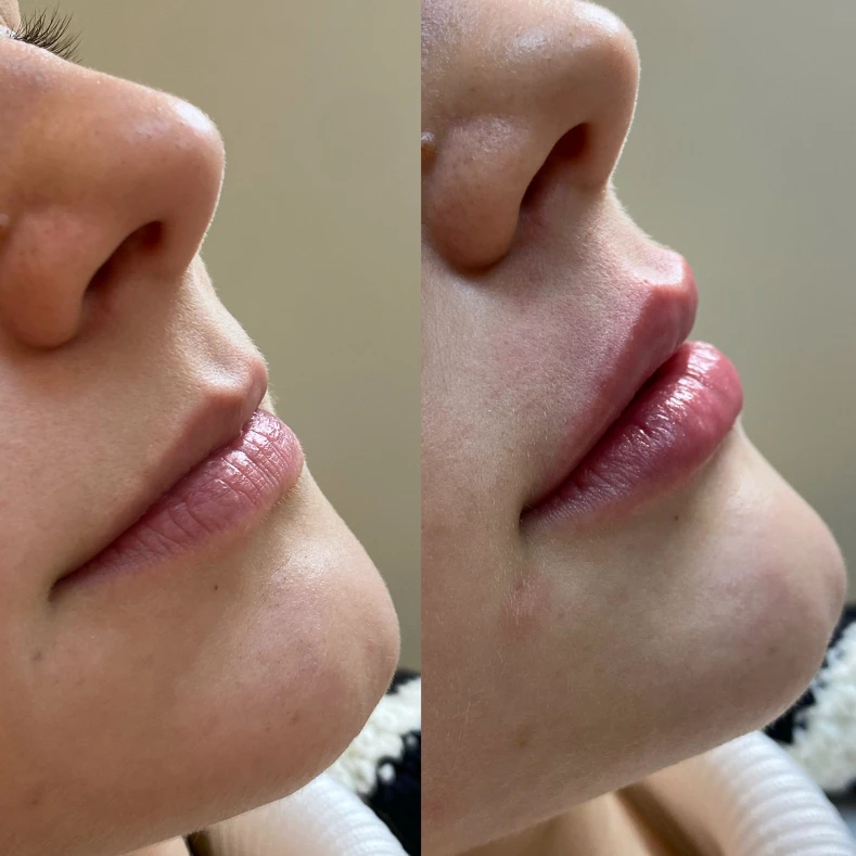 AeD Carolina - Bruno Conzi - 2