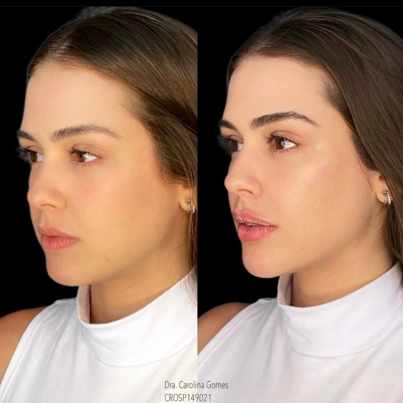 AeD Carolina - Bruno Conzi - 3